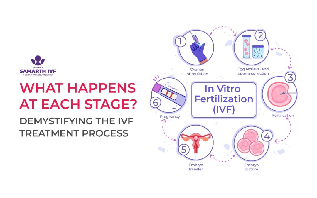 What Happens at Each Stage? Demystifying the IVF Treatment Process