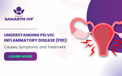 Understanding Pelvic Inflammatory Disease (PID): Causes, Symptoms, and Treatment