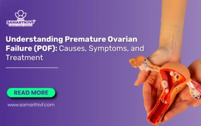 Understanding Premature Ovarian Failure (POF): Causes, Symptoms, and Treatment